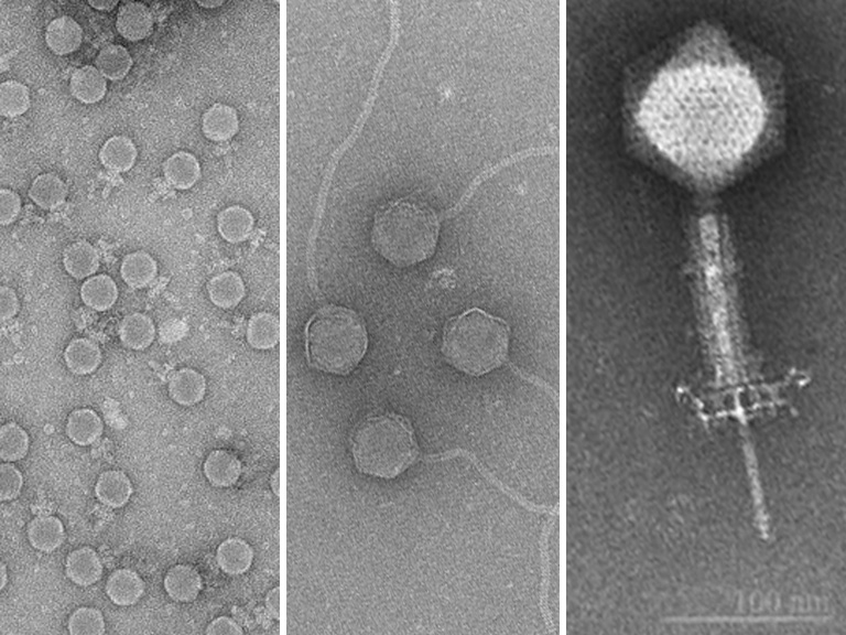 © Pauline Göller / ETH Zurich / under project NRP72 «Antimicrobial Resistance / Project PI: Elena Gómez-Sanz